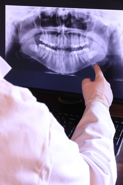 Best Emergency Root Canal Therapy in Corunna, MI