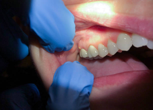 Best Weekend Emergency Dental Services in Corunna, MI
